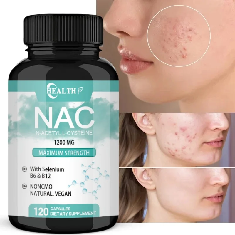 NAC Supplement N-Acetyl Cysteine Capsules 1200mg Maximum Strength L-Glutathione Potent Antioxidant Support Skin Health