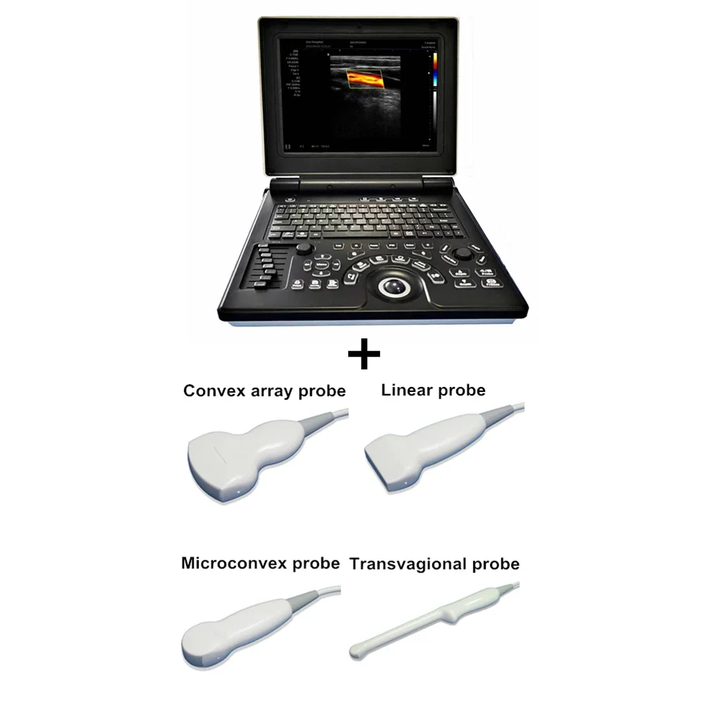 12 Inch Advanced 3D Color Doppler Medical Portable Laptop Notebook Pregnancy Ultrasound Scanner Machine