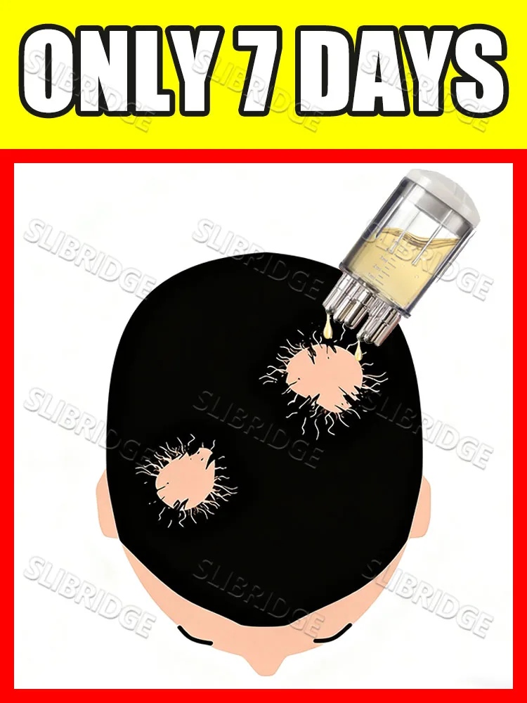 

2025 горячая распродажа, уход за кожей головы (бесплатная доставка)