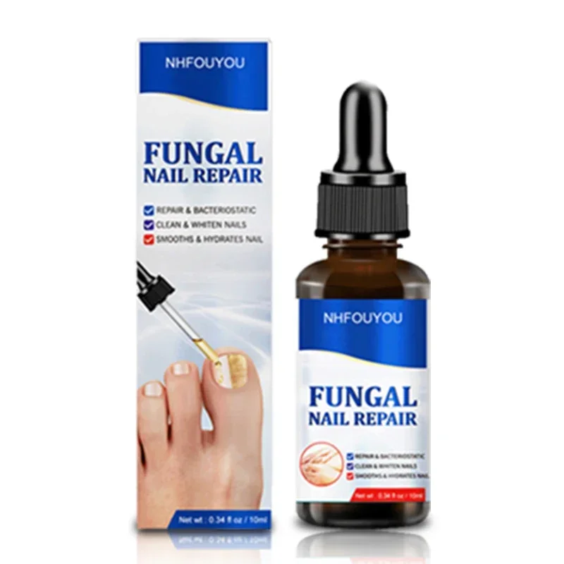 Aceite para tratamiento de uñas por hongos, esencia para reparación de pies, Gel para eliminación de hongos en las uñas de los pies, crema antiinfección, 10ML