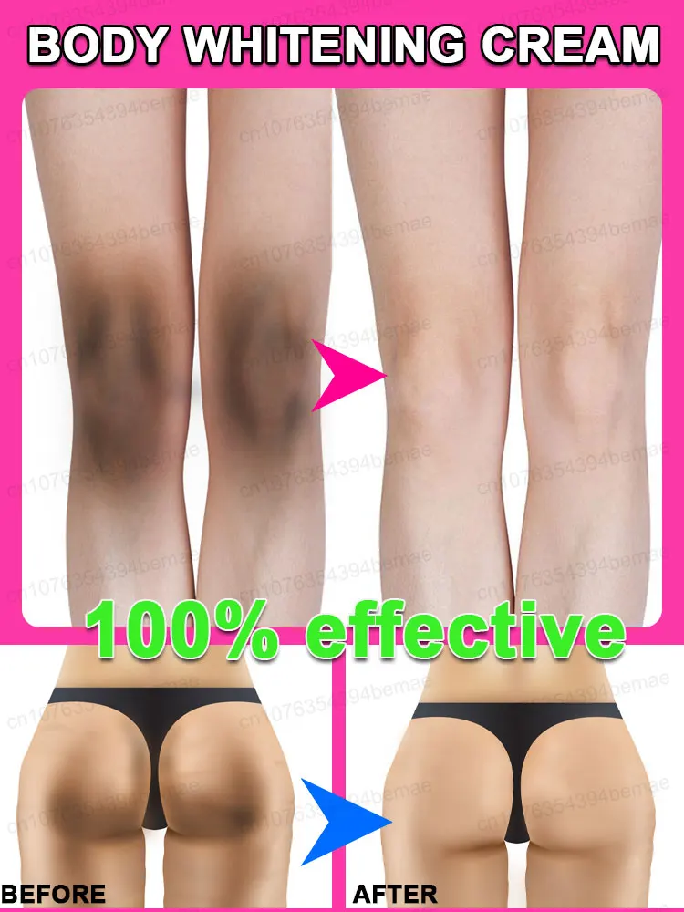 

Whitening Cream Private Parts UnderarmBleaching Serum Whiten Butt Knee BrightenInner Thigh Intimate Parts Dark Remove Melanin