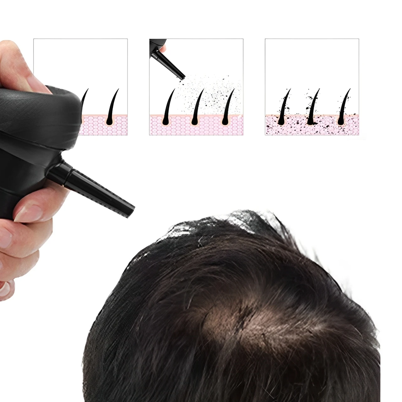 

Hair Fiber Spray Applicator Hair Building Fiber Applicator Extension Nozzle Pump For Hair Loss Extensions Hair Sprinkler Nozzle