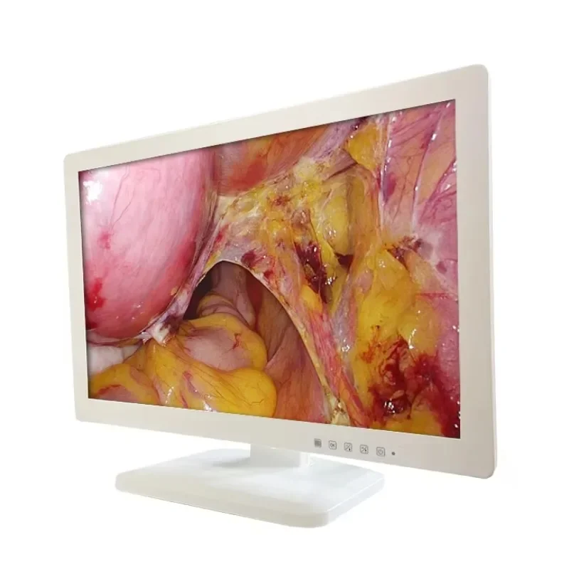 

24 Inch HD Surgical Monitor for Laparoscopy Surgical