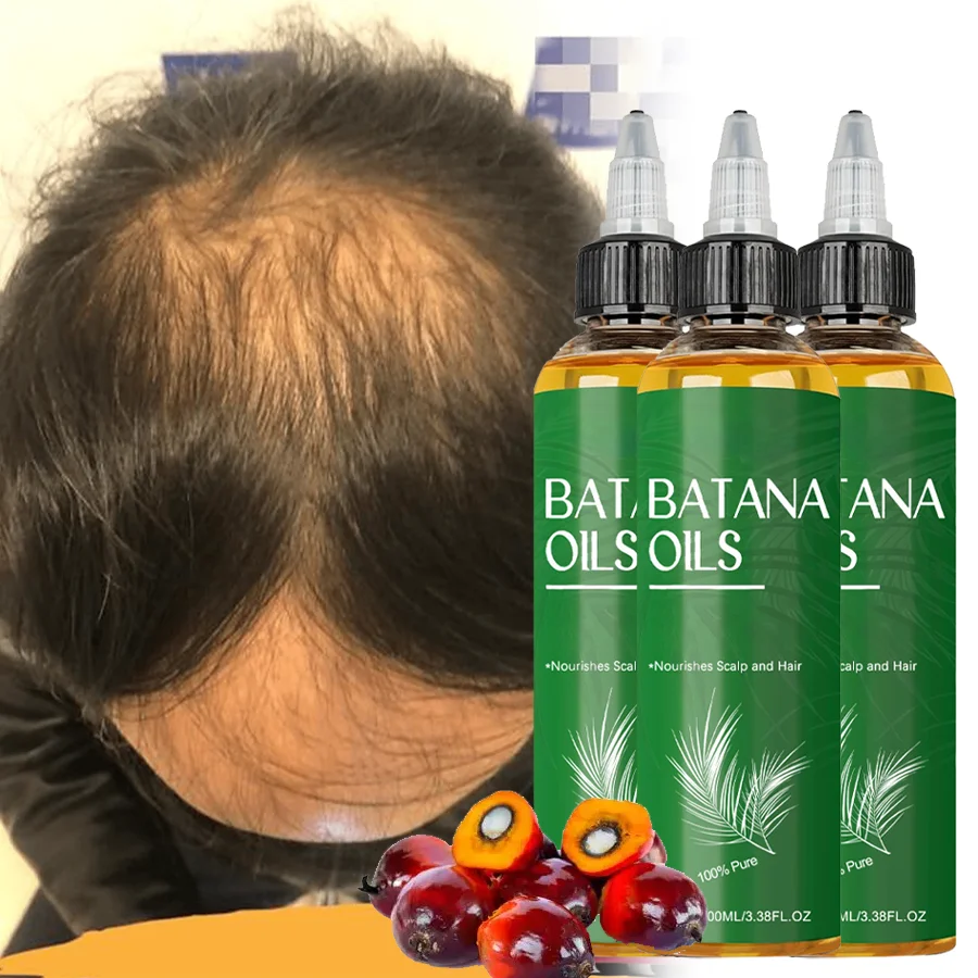 

3 yra Batana Эфирное масло для роста волос Плотное укрепление волос Предотвращение выпадения Улучшение сухости волос Сплит Увлажнение блестящих волос