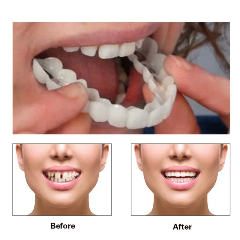 NUEVA cubierta de dientes falsos, ajuste perfecto, blanqueamiento dental, carillas de sonrisa de silicona a presión, Dentaduras dentales Flexibles, herramienta de belleza cosmética