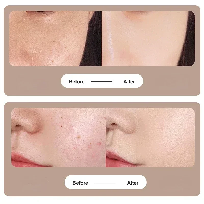 Zinklegering Microneedle Massager Roller Facial Rimpel Remover Handleiding Micropin Huidverzorging Beauty Tool Apparaat Dermaroller voor Gezicht