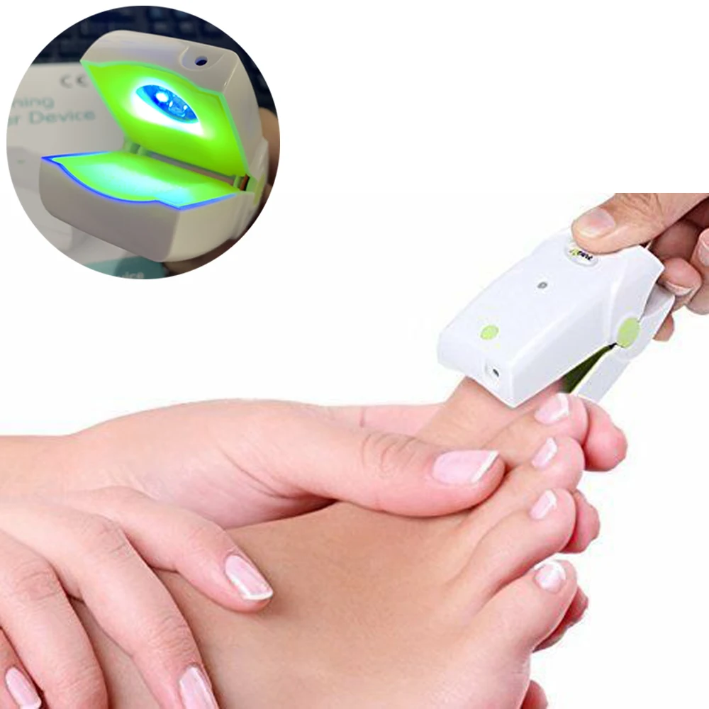 

Fingernails Toenails Toe Nail Fungus Cold Laser Therapy Onychomycosis Treatment Device Instrument Anti Fungal Rechargeable LLLT