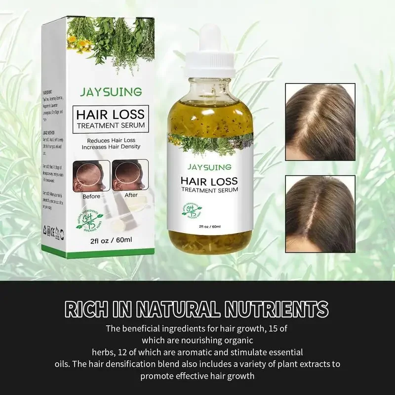 Scalp Densification Oil essence Liquid Growth Massage Nourishing Oil for Strengthening Hair Suitable all hair types conditioner