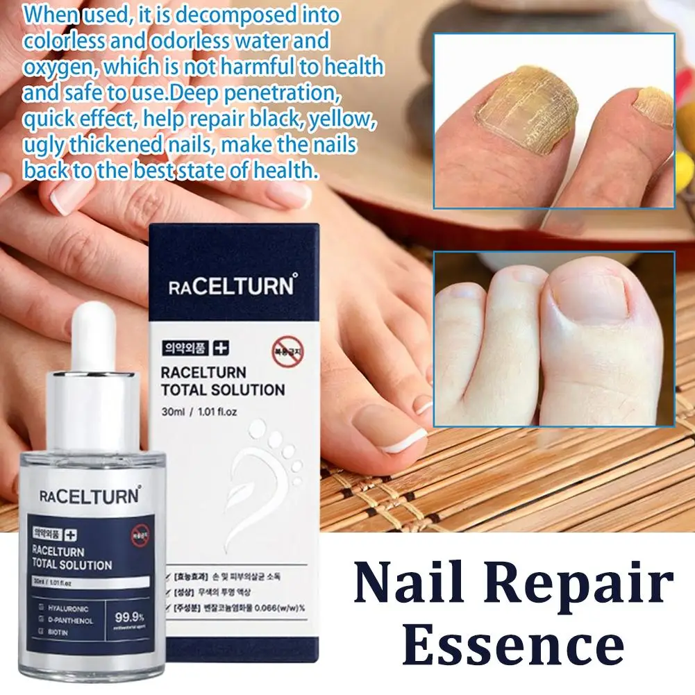 

30 мл эссенция для восстановления ногтей, уход за ногтями на ногах, питательная, увлажняющая, сухая, грубая кожа, мягкая, гладкая, быстро впитывающая, против пилинга