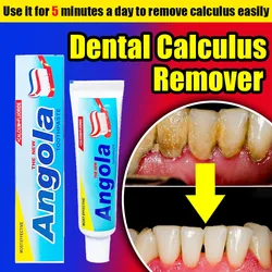 Dental Calculus Remover