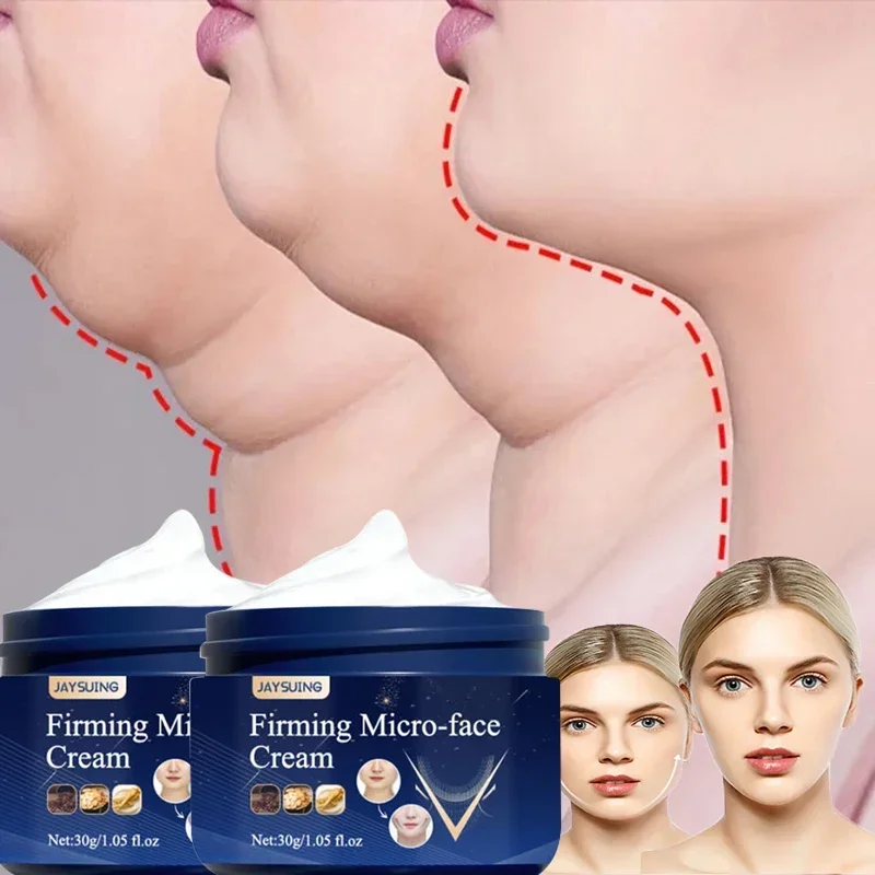 V-Shape Slimming Cream Removal Double Chin Firming Face-lift Slimming  Masseter Muscle Face Fat Burning Anti-aging Products