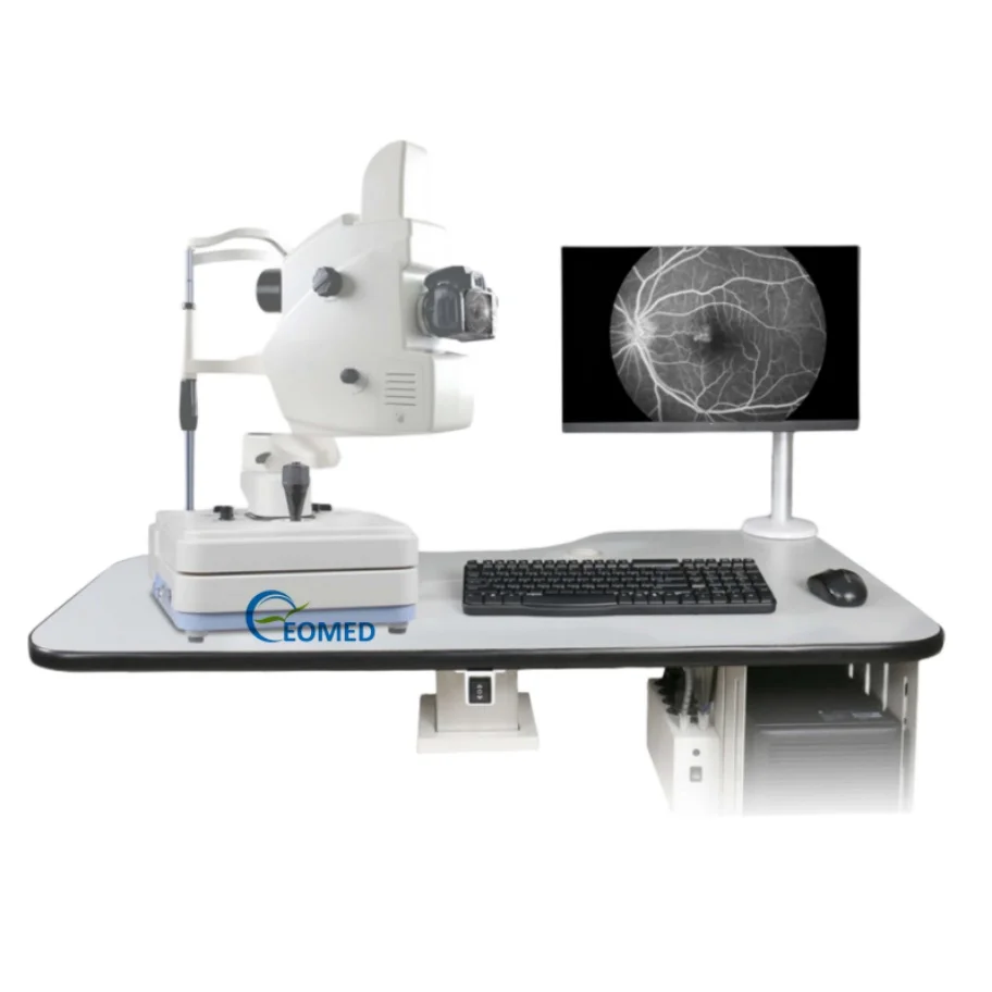 High Efficient Professional EOMED Ophthalmic Equipment Non-Mydriatic Retinal/Fundus Camera Fluorescein Angiography System 1 Year