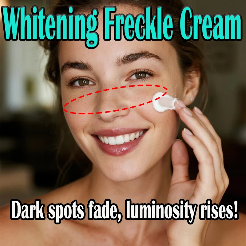 eelhoe Niacinamide Melasma Brightening Cream Reduce Melanin Brighten Lighten Dark Skin Chloasma Fades Stubborn Discoloration