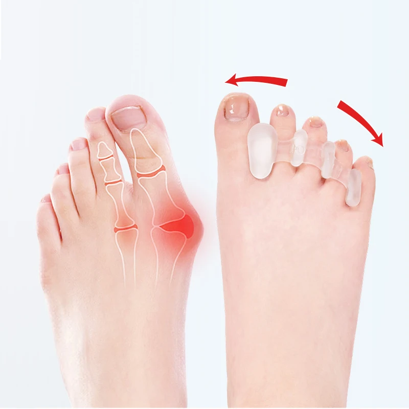 Silicone Toes Separator Bunion Bone Ectropion Adjuster Toes Outer Appliance Foot Care Tools Hallux Valgus Corrector