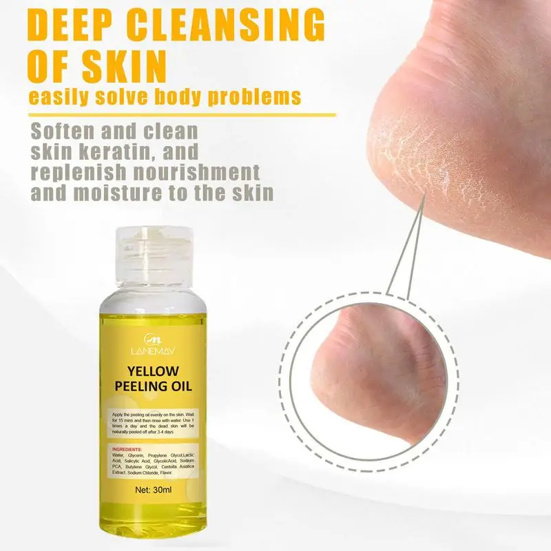 Aceite Peeling amarillo fuerte, aclara los codos, rodillas, manos, melanina, incluso tonifica la piel y blanquea la piel