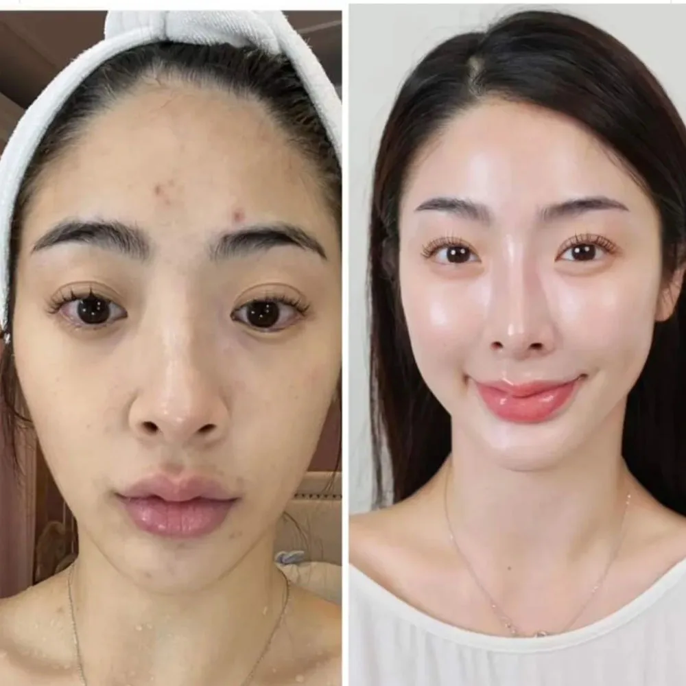 Thailand VC VITC dua dalam satu gel, Serum Wajah memperkaya Vitamin C, menghilangkan noda kulit jerawat halus cerah putih jelas kulit muda