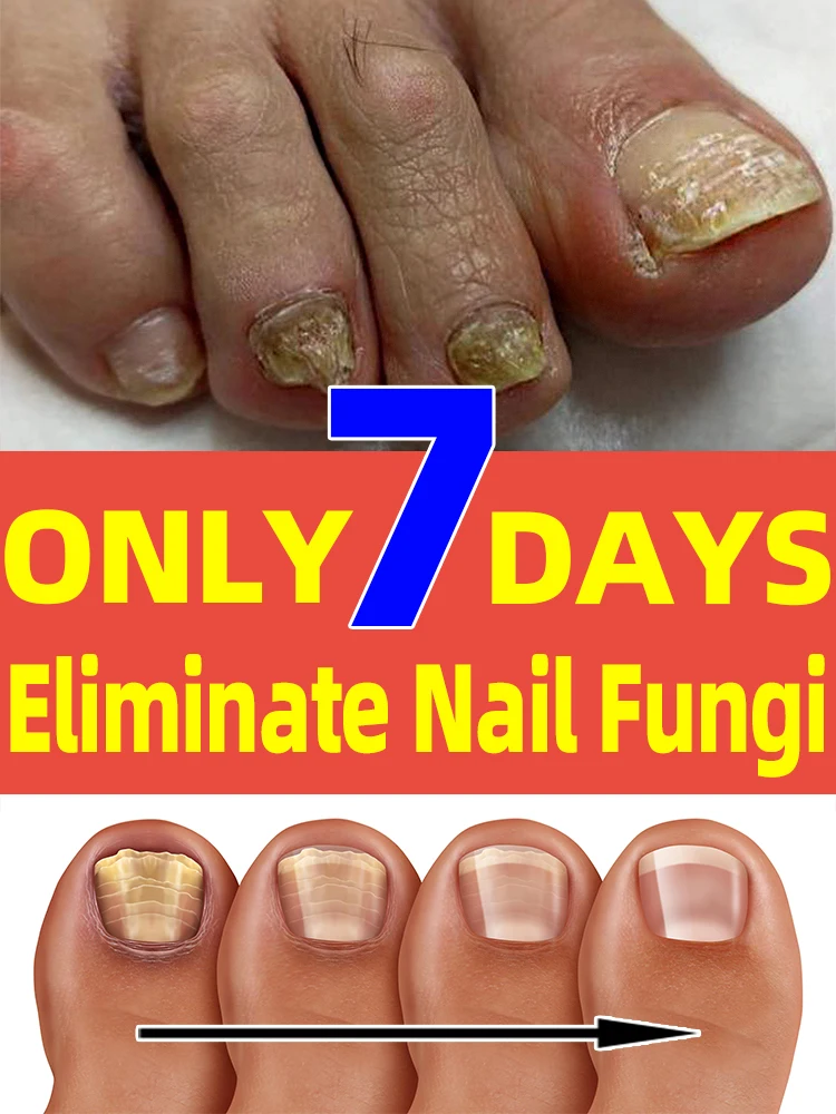 

Use foot soaking in the bathroom simultaneously to eliminate the source of infection without leaving any hidden dangers.