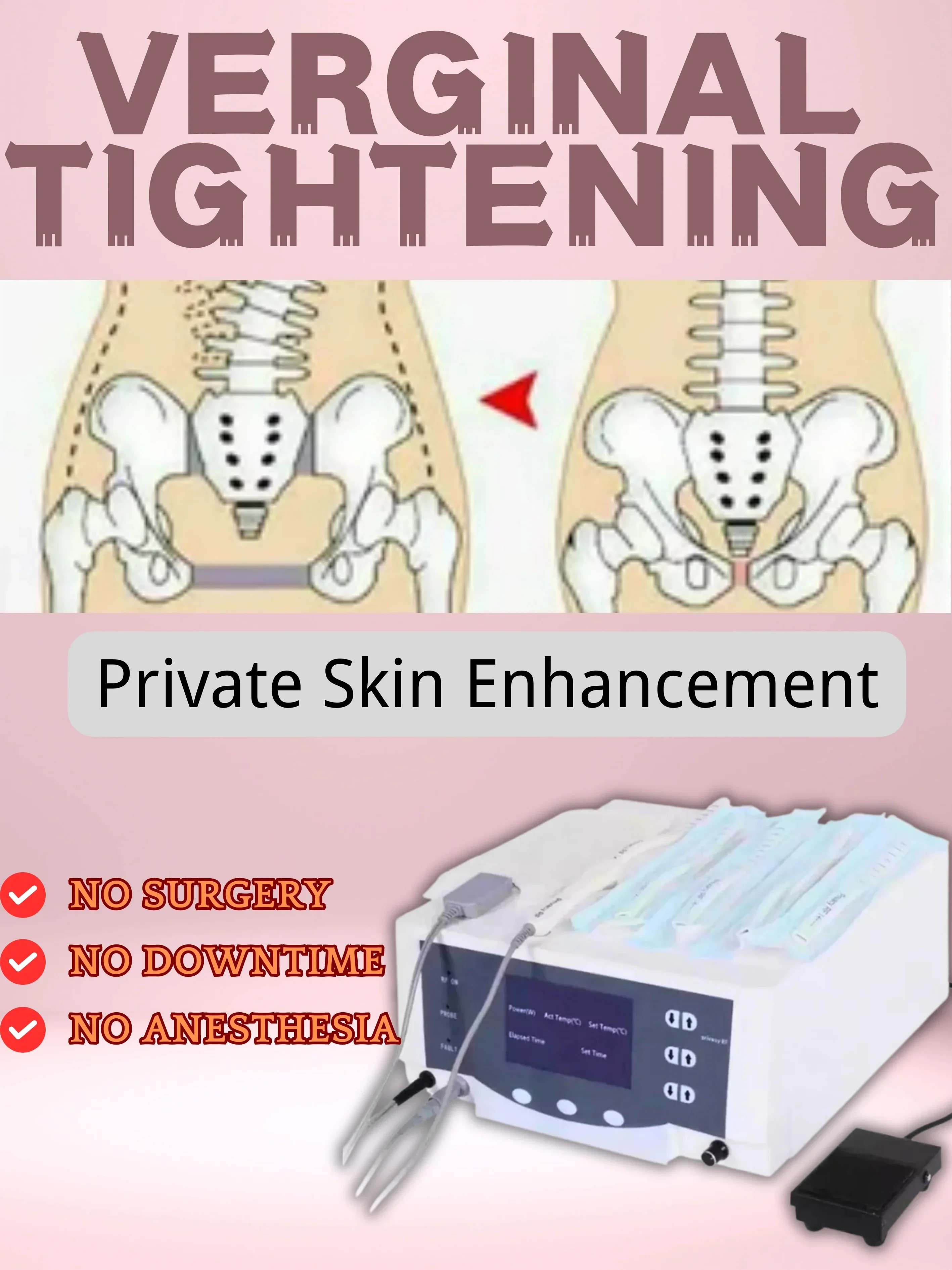 

Thermiva Fractional RF Machine For Private Skin Lift Rejuvenation Private Care Tightening Repair Fraction Rf Machine