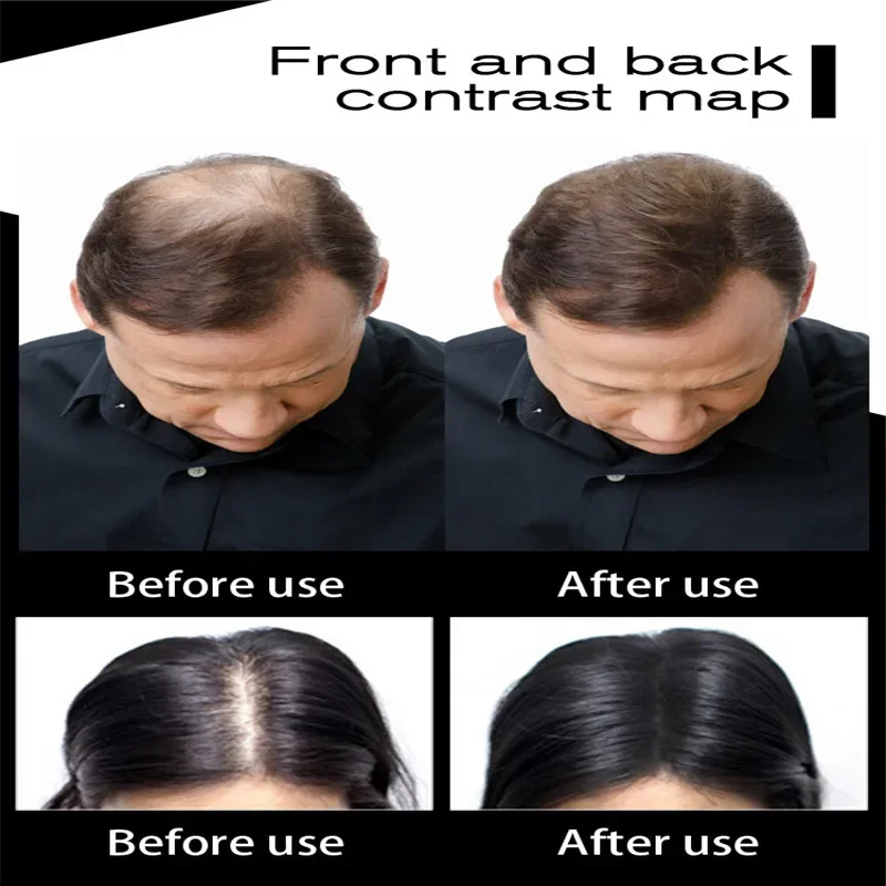 27.5g  Hair Fibers Keratin Thickening Spray Hair Building Fibers Loss Products Instant Wig Regrowth Powders ,Promotion
