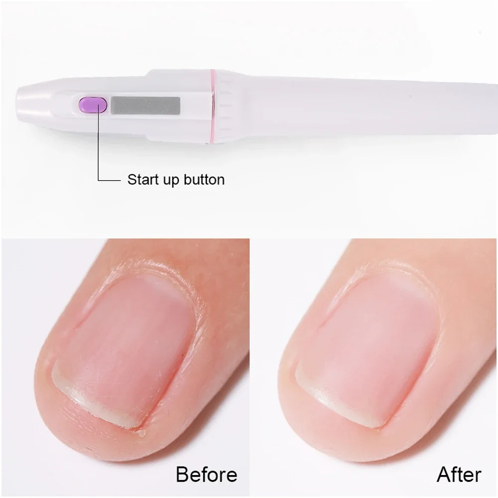 Elektrisches Nagelbohrer-Set, Nagelfeilen mit 5 austauschbaren Bohrern zum Peeling, Schleifen, Polieren, Entfernen von Acryl-Gel-Nägeln