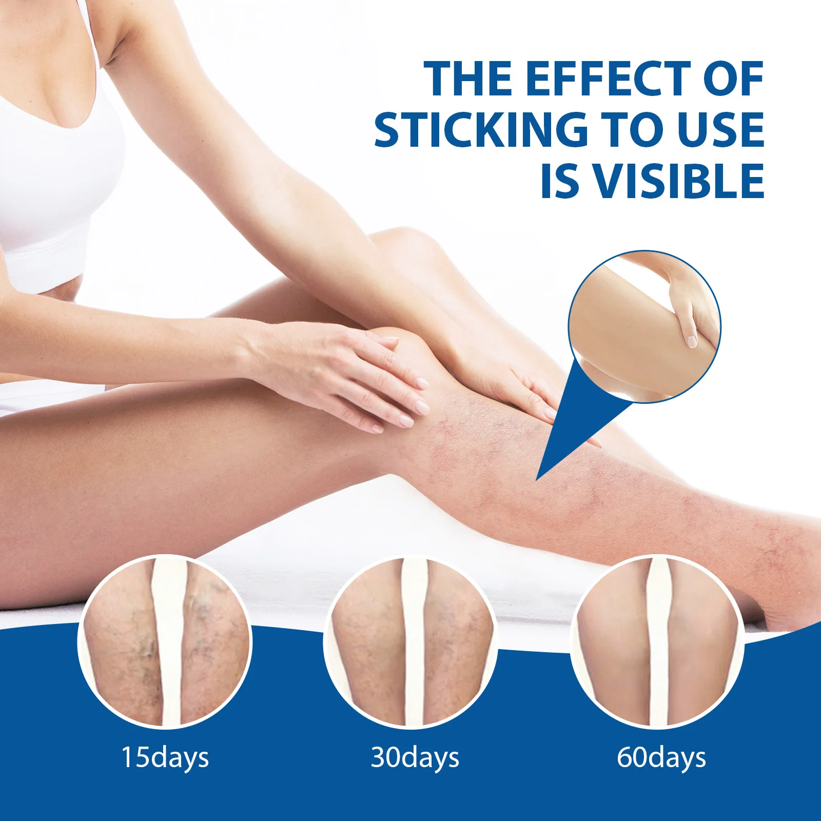 Vein Massage Cream Relieve Leg Vascular Bulge and Pain Earthworm Anti-Thrombosis