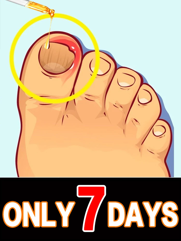 2025 핫 세일 손톱 문제는 이제 안녕! 간편하고 편리합니다