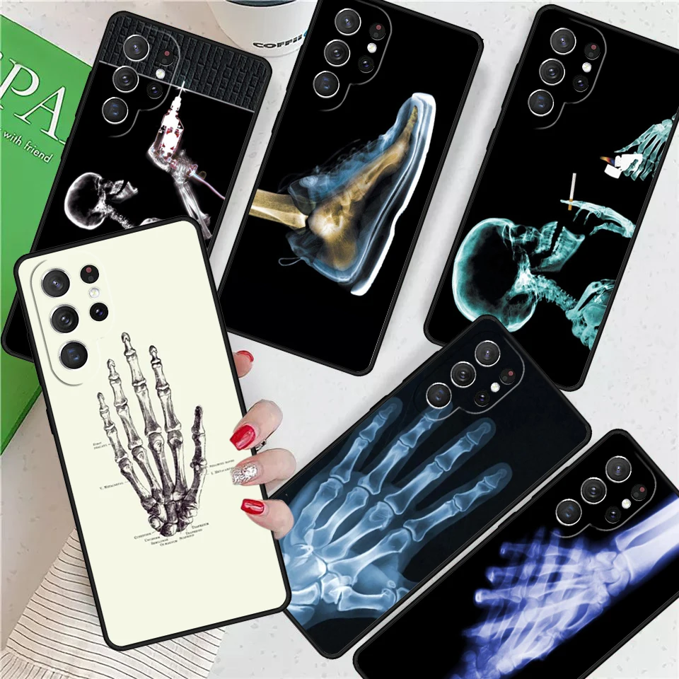 X-ray Hand Bones For Samsung Galaxy S24 Ultra S21 S22 S8 S9 S10 5G Note 10 20 Plus FE S23 Phone case Cover Coque