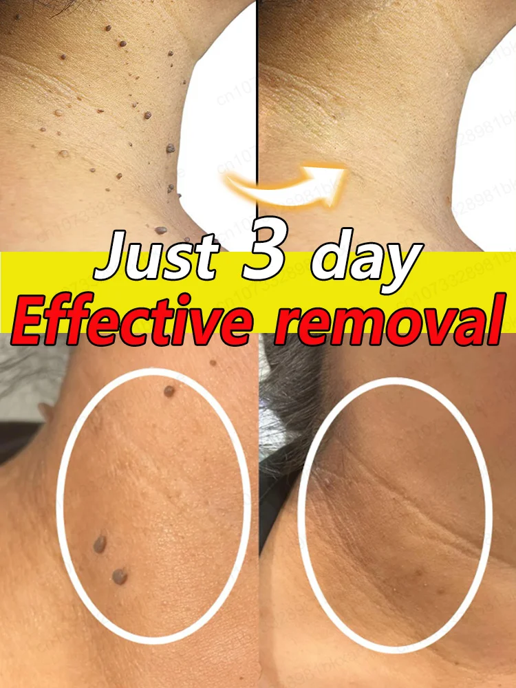 

Remove the dirt from your body