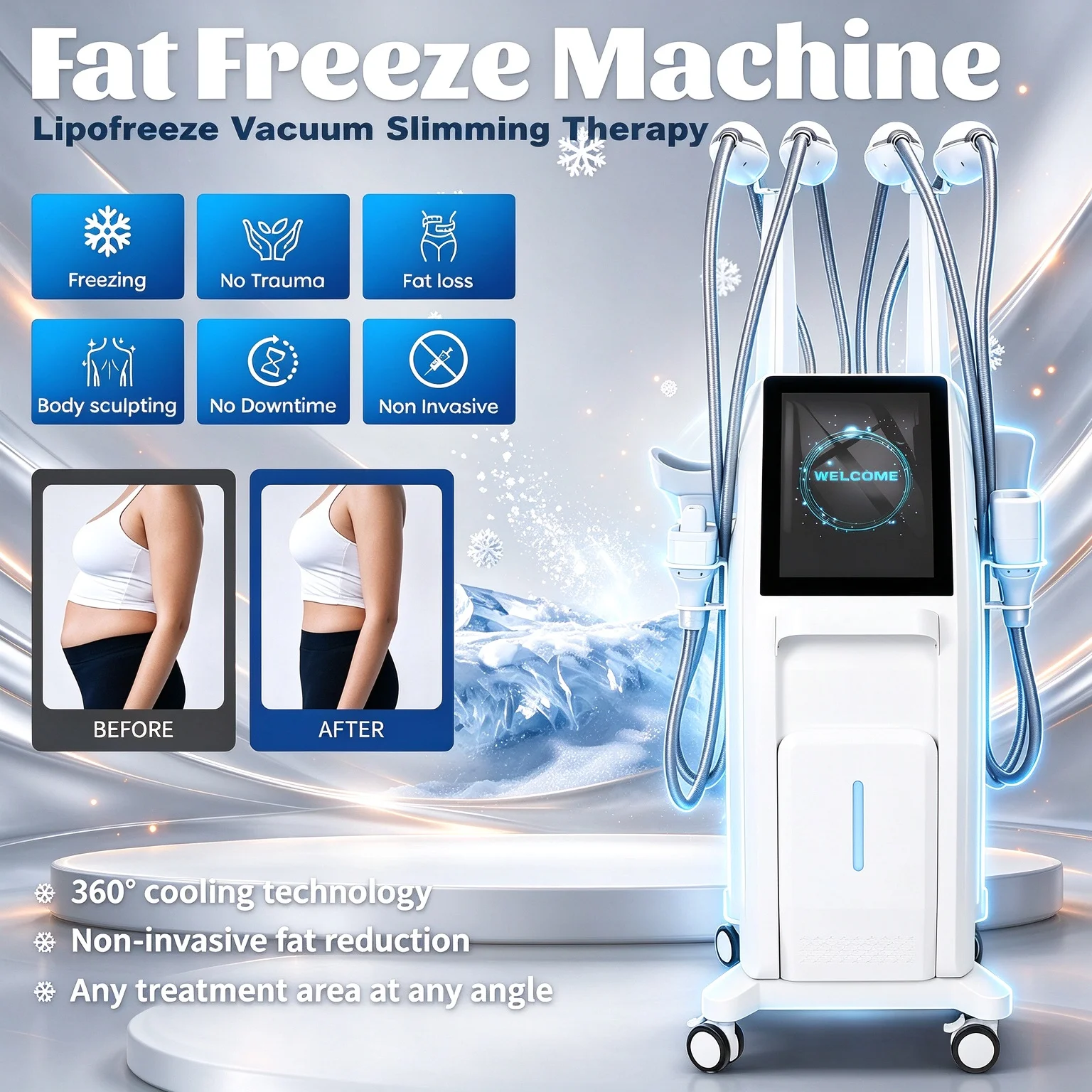 360° Surround Cooling Body Sculpt Machine 4 Handles 6 Probes 4‑Channel Simultaneous Work Non‑Invasive Cellulite Removal Salon