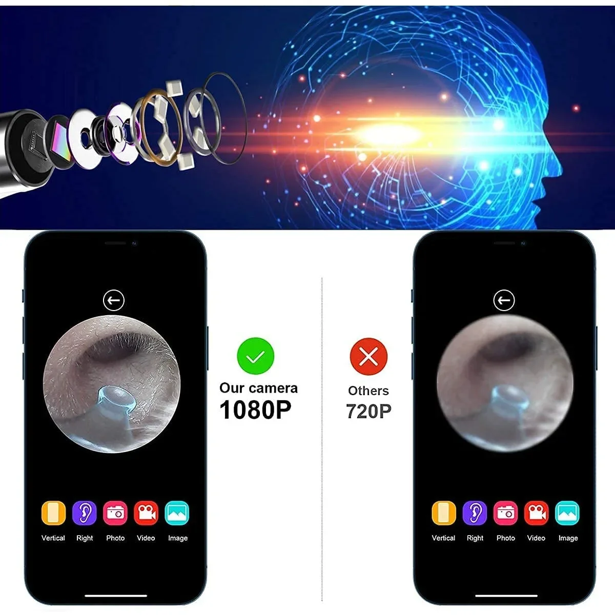 เครื่องมือทำความสะอาดหูแบบแท่งอุปกรณ์ดูแลสุขภาพ300W เครื่องมือทำความสะอาดหูแบบแท่งส่องหูกล้องขนาดเล็กความแม่นยำสูง