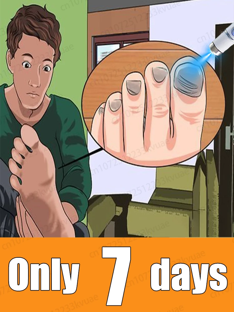 

Say goodbye to onychomycosis, no recurrence, no damage to nails.