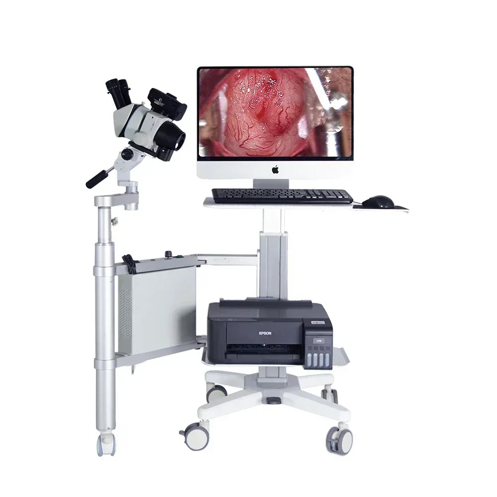 رائجة البيع عالية بكسل نطاق كولبو البصري لايكا عدسة بصرية ZY-9900C لفحص المهبل