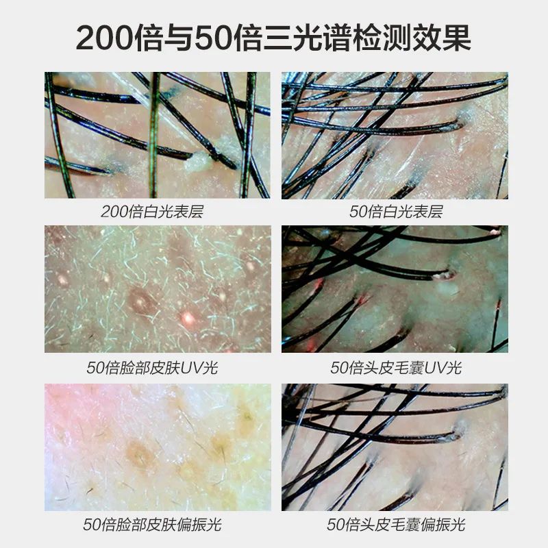 11 Inch HD Scalp & Skin Analyzer 50X-200X Digital Microscope Hair Follicle Facial Pore Tester All-in-One Salon Equipment