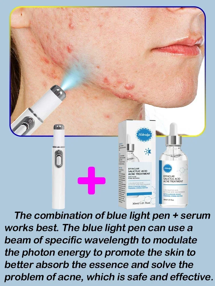 acne laser anti Acne serum