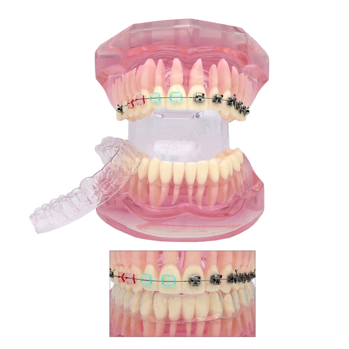 

Dental Teaching Model with Invisible Bracket Dentistry Model Orthodontic Transparent Retainer for Dentist Demo Study