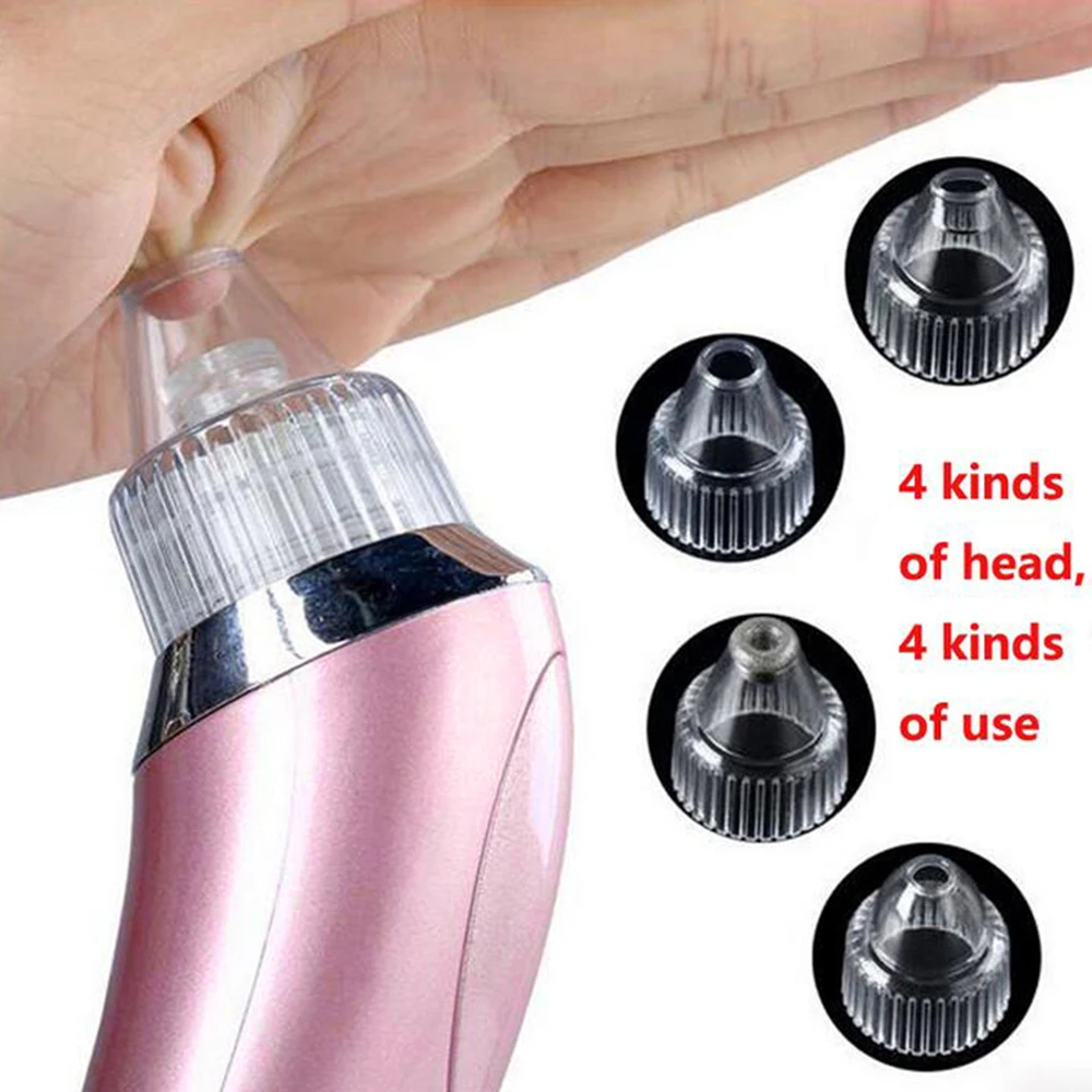 Xn-8030 Powerful Suction Easy To Use High-quality Trending Innovative Must-have Suitable For Sensitive Skin Blackhead Removal