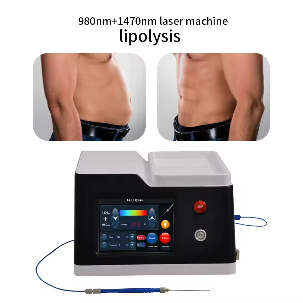 2025 مصدر المصنع 1470nm 980nm ليزر الرفع الداخلي 2 أطوال موجية للدقة المتقدمة ومتعددة الاستخدامات في الليزر الاحترافي