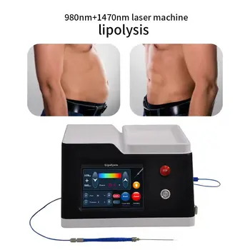 2025 Source Factory endoliftingový laser 1470nm 980nm 2 vlnové délky pro pokročilou přesnost a všestrannost v profesionálním laseru 10 nejlepší prodej 1470 nm - №4