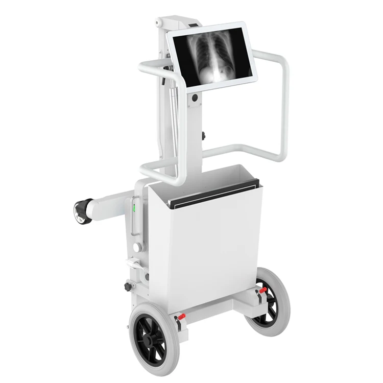 ray Machine Mobile DR Radiography System