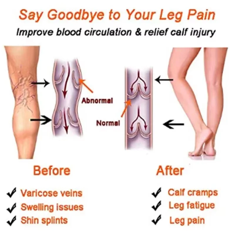 Women Compression Socks Slimming Sock Men Outdoor Sports Prevent Calf Varicose Veins Soreness Pressure Calf Stocking Sock view 4