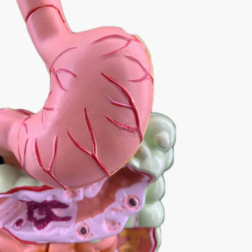 Imagem -06 - Modelo do Sistema Digestivo Humano Anatomia Intestino Grande Reto do Cecum Estrutura dos Órgãos Internos Estômago