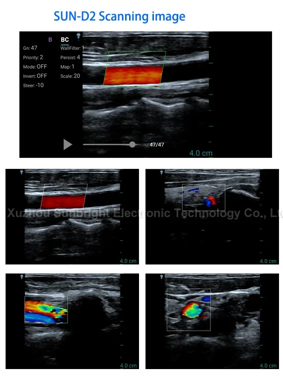 Veterinary Laptop Full Digital Ultrasound With Cats Dogs Sheep 2023 Year Biggest Sales