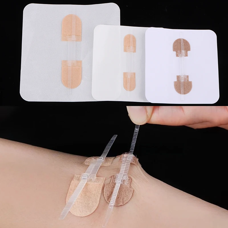 1Pcs Fast Suture Zipper Band-Aid Zipper Tie Wound Closure Patch Hemostatic Patch Wound Outdoor Portable