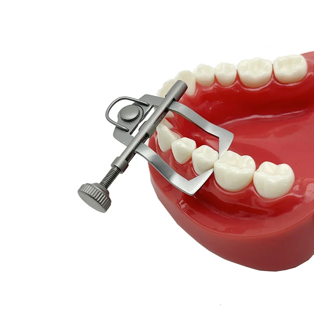 

Стоматологический ортодонтический передний/закрытый разделитель зубов, сепаратор, втягивающий фиксатор, матрица, резиновая плотина, инструмент для разделения зубов стоматолога