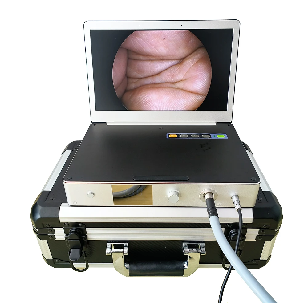 

Top Quality 15.6inch/11.6inch 1080P Full HD EndoscopeSystem with 100W/30W LED Light Source