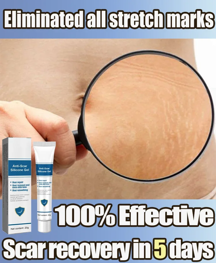 Cream For Pregnancy Stretch Marks Removal Eliminate Red White Old Stretch Marks Oil