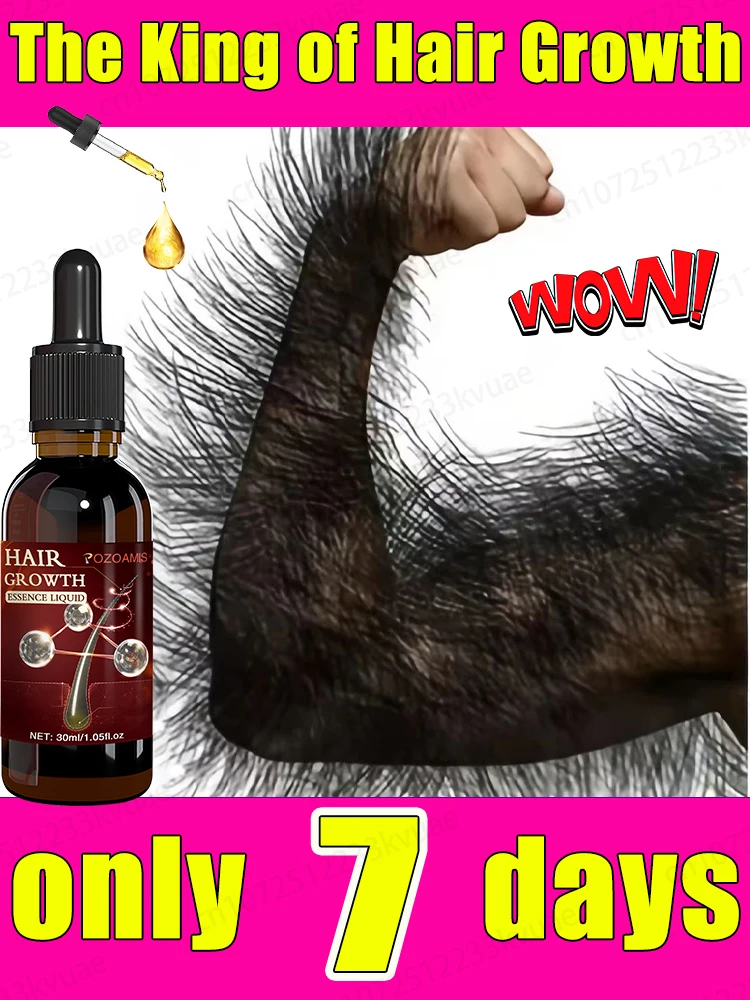

Baldness terminator, save your hairline, thick hair in just 7 days
