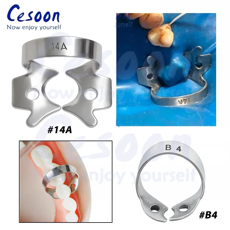 1 قطعة/الحزمة الأسنان المطاط السد المشابك 50 أحجام حاجز كليب استعادة السد حامل قصاصة لأداة معدات المواد تقويم الأسنان عن طريق الفم #4