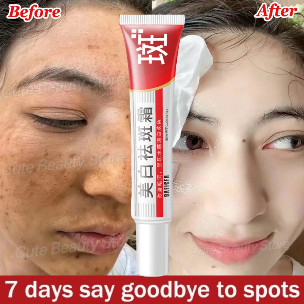 

Effective Whitening Freckles Face Cream Remove Melasma Dark Spots Fade Melanin Acne Scars Anti-aging Brighten Repair Skin Care