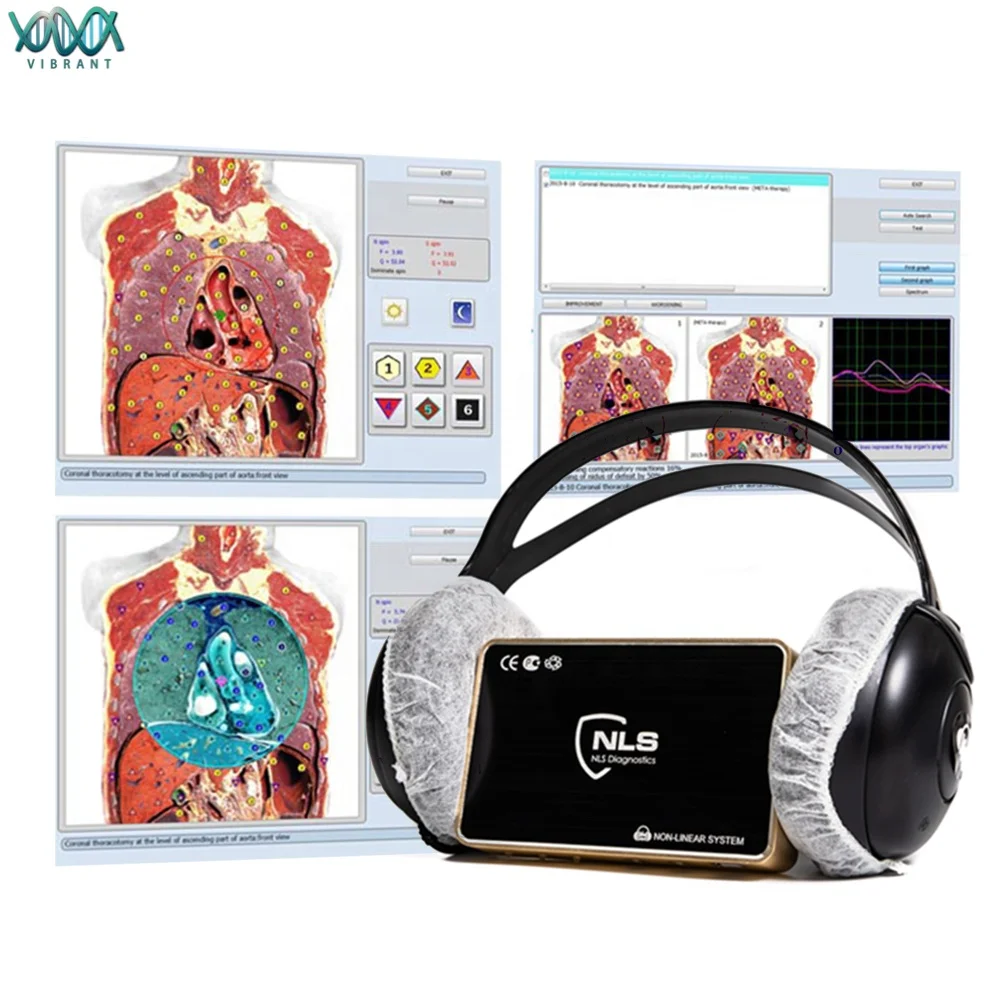 Factory Price Original 17d NLS Non Linear Diagnostic System Medical Body Analysis Machine With Aura And Chakra